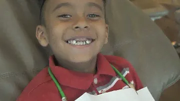Fluoride Varnish - A Cavity Fighting Tool!